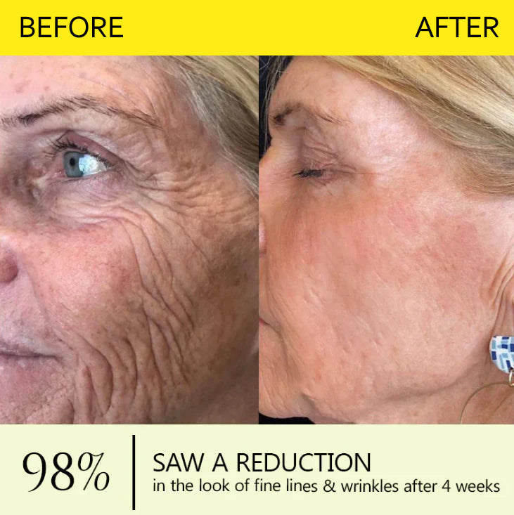 ⭐️Botox & Retinol Shot - Eraser for Deep Wrinkles, Sagging Jowls & Puffy Eyes