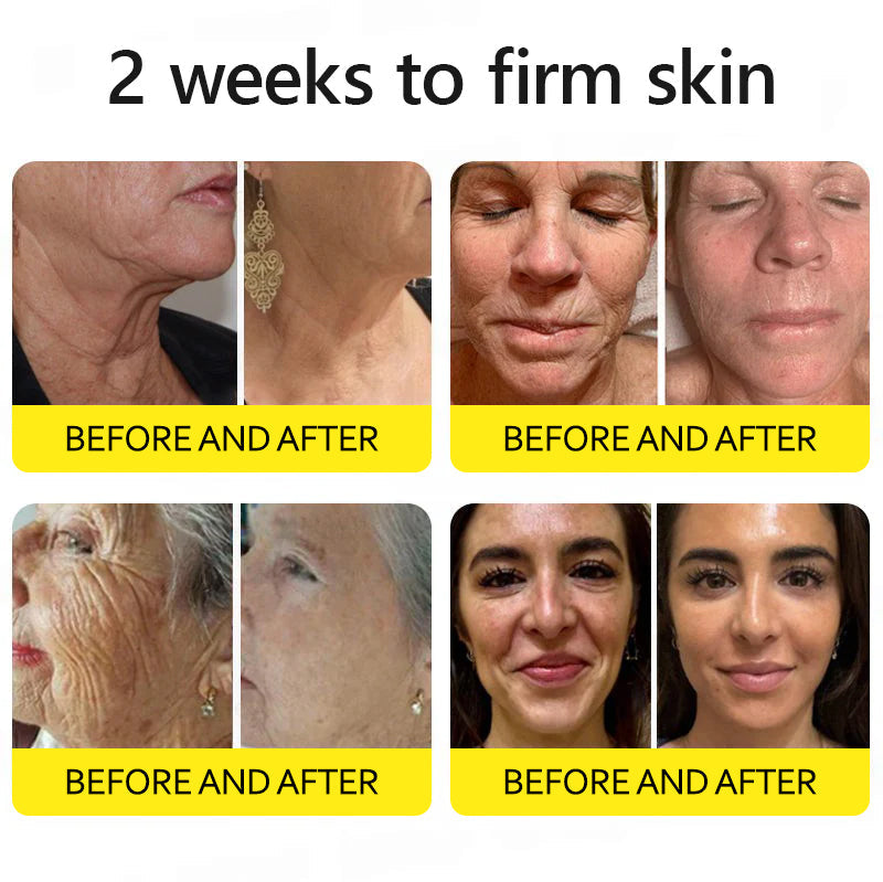 ⭐️Botox & Retinol Shot - Eraser for Deep Wrinkles, Sagging Jowls & Puffy Eyes