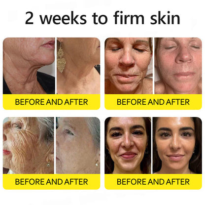 ⭐️Botox & Retinol Shot - Eraser for Deep Wrinkles, Sagging Jowls & Puffy Eyes