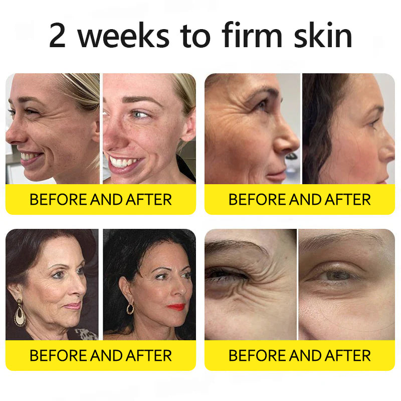 ⭐️Botox & Retinol Shot - Eraser for Deep Wrinkles, Sagging Jowls & Puffy Eyes
