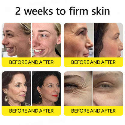 ⭐️Botox & Retinol Shot - Eraser for Deep Wrinkles, Sagging Jowls & Puffy Eyes