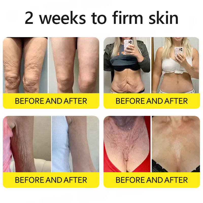 ⭐️Botox & Retinol Shot - Eraser for Deep Wrinkles, Sagging Jowls & Puffy Eyes