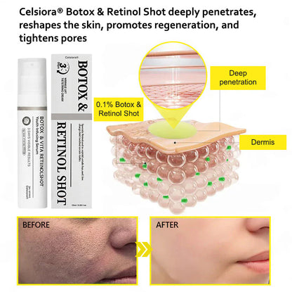 ⭐️Botox & Retinol Shot - Eraser for Deep Wrinkles, Sagging Jowls & Puffy Eyes