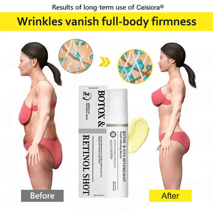 ⭐️Botox & Retinol Shot - Eraser for Deep Wrinkles, Sagging Jowls & Puffy Eyes